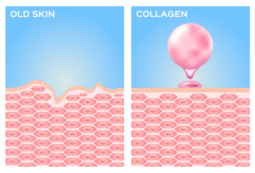 collagene benefici pelle