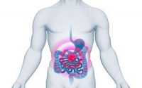 Morbo di Crohn: sintomi, diagnosi, alimentazione, cura