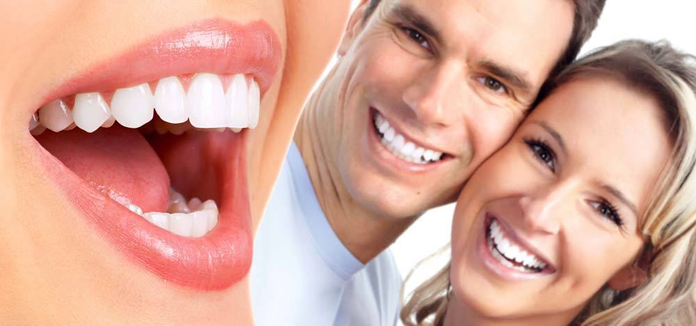 persone sorridenti denti bianchi sbiancamento