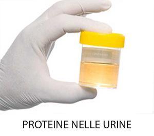 proteine nelle urine