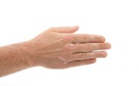Psoriasi alle mani: come si manifesta, cure e trattamenti